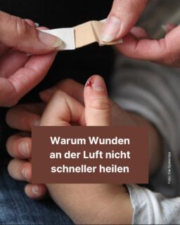 Timeline-Warnung: Blut 🧛

Aua: Mal schneidet man sich beim Kochen mit dem Messer, mal schürft man sich das Knie leicht auf. Unser Körper ist aber sehr gut darin, kleine Wunden schnell wieder zu heilen: Doch schon lange gibt es den Irrglauben, dass das besser funktioniert, wenn die Wunde an der Luft und nicht zum Beispiel unter einem Pflaster ist. Warum das nur ein Mythos ist, liest du in diesem Info-Post! 😊

#pflaster #wunde #blut #aua #schmerz #mythos #irrtum #funfact #zeitung #freistunde